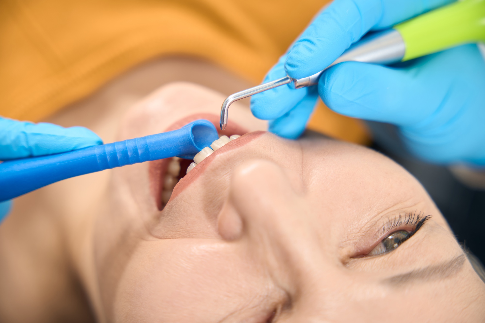 Female patient visiting dentist to professionally clean and polish her teeth